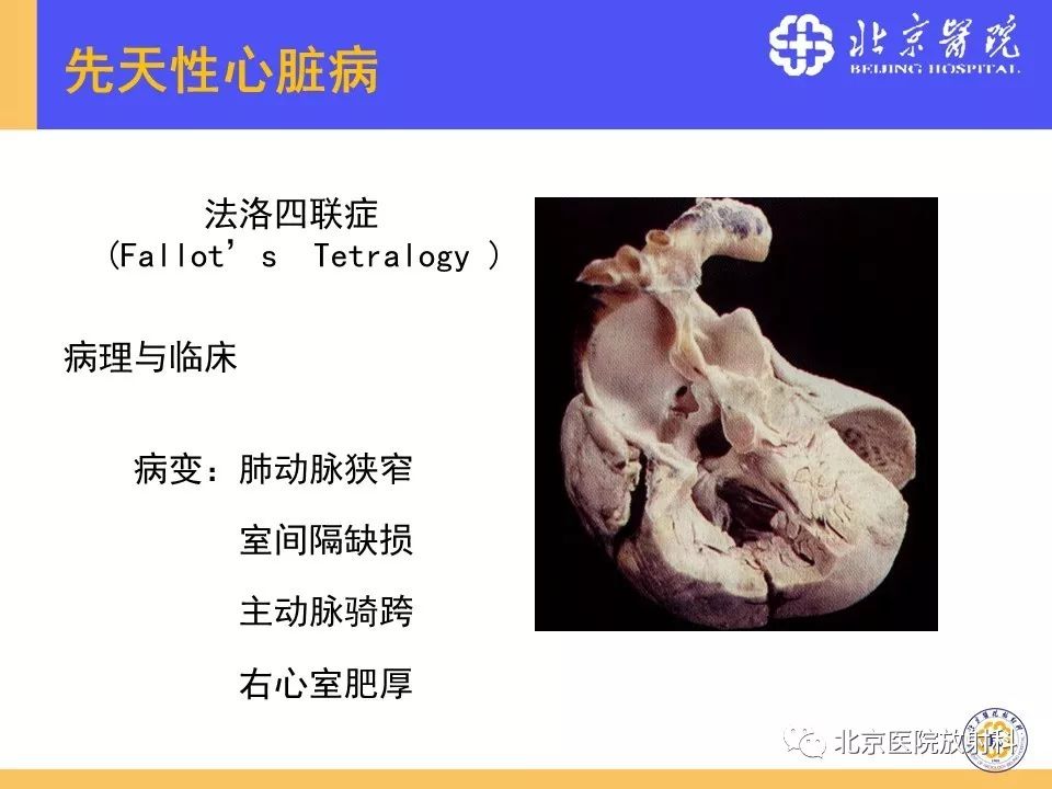 【PPT】心脏病变的影像诊断