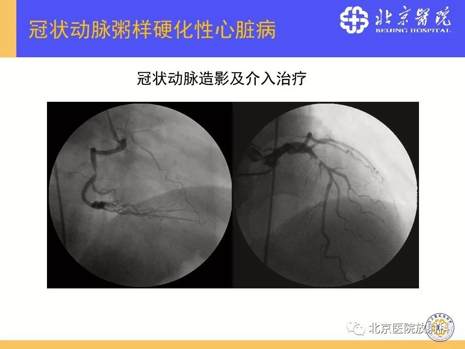 【PPT】心脏病变的影像诊断