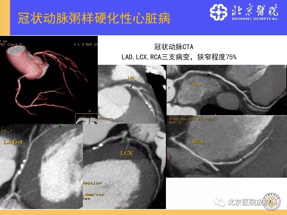 【PPT】心脏病变的影像诊断