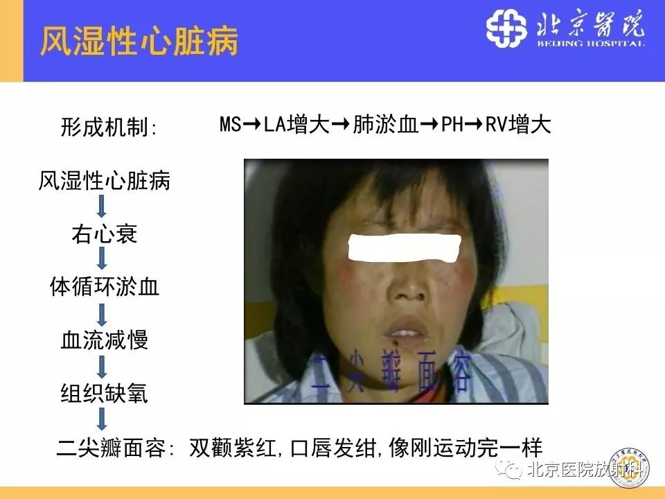 【PPT】心脏病变的影像诊断