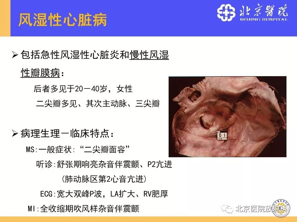 【PPT】心脏病变的影像诊断