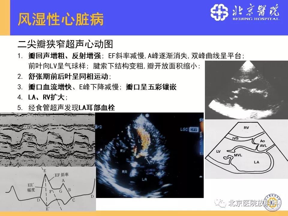 【PPT】心脏病变的影像诊断