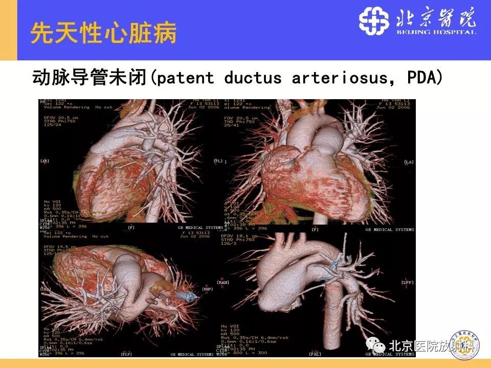 【PPT】心脏病变的影像诊断