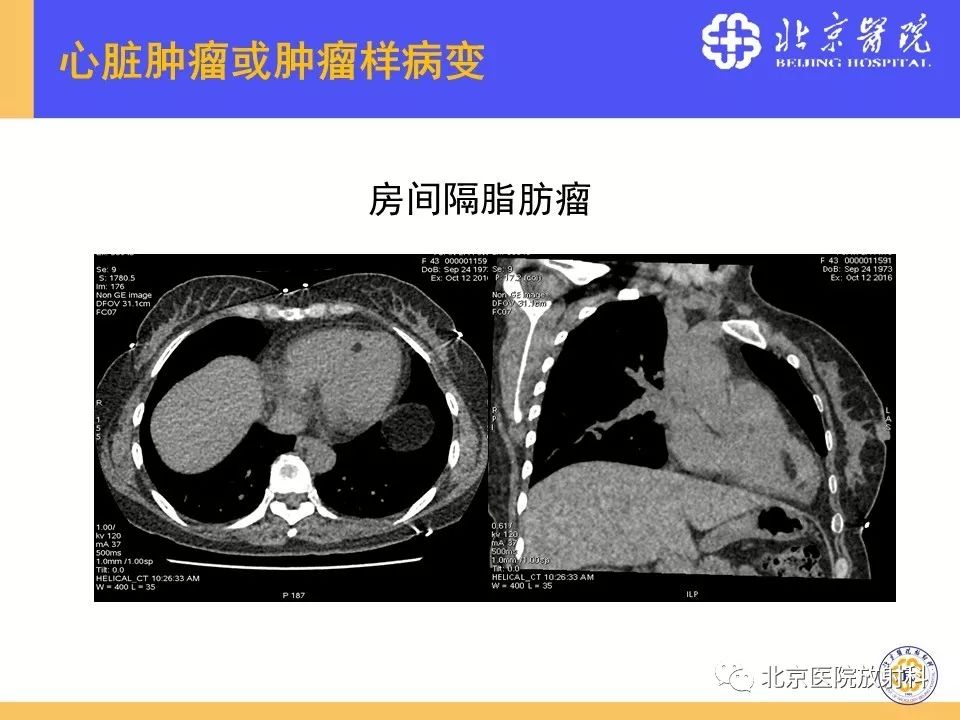 【PPT】心脏病变的影像诊断