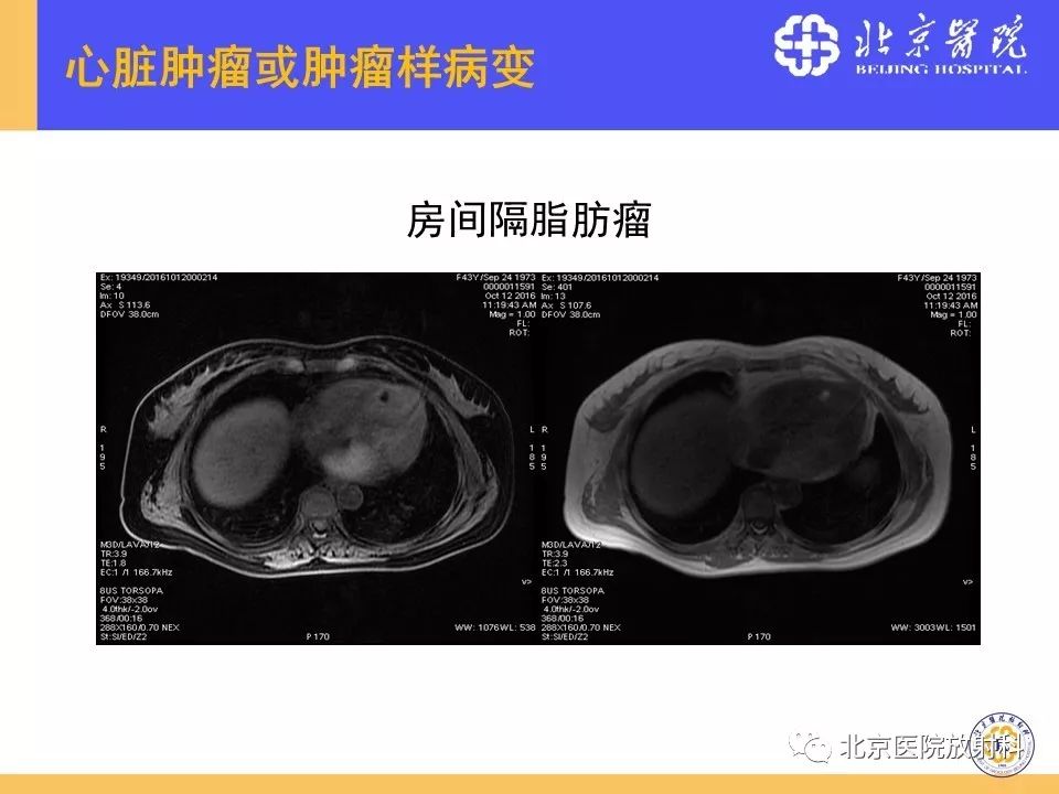 【PPT】心脏病变的影像诊断