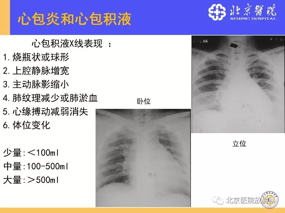 【PPT】心脏病变的影像诊断