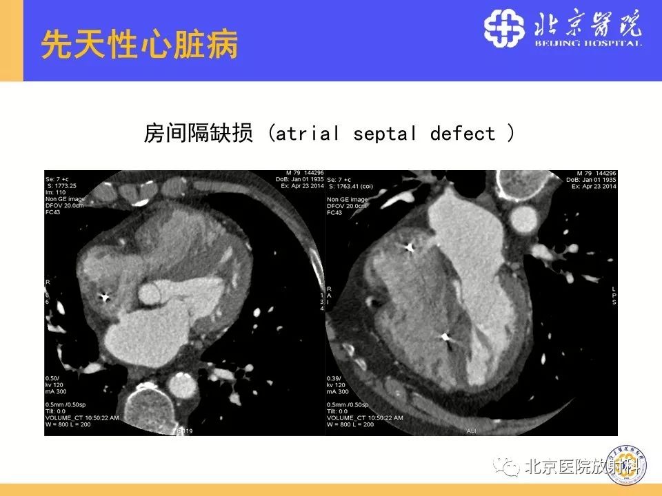 【PPT】心脏病变的影像诊断