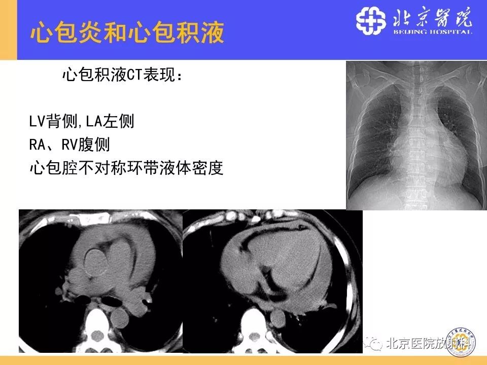 【PPT】心脏病变的影像诊断