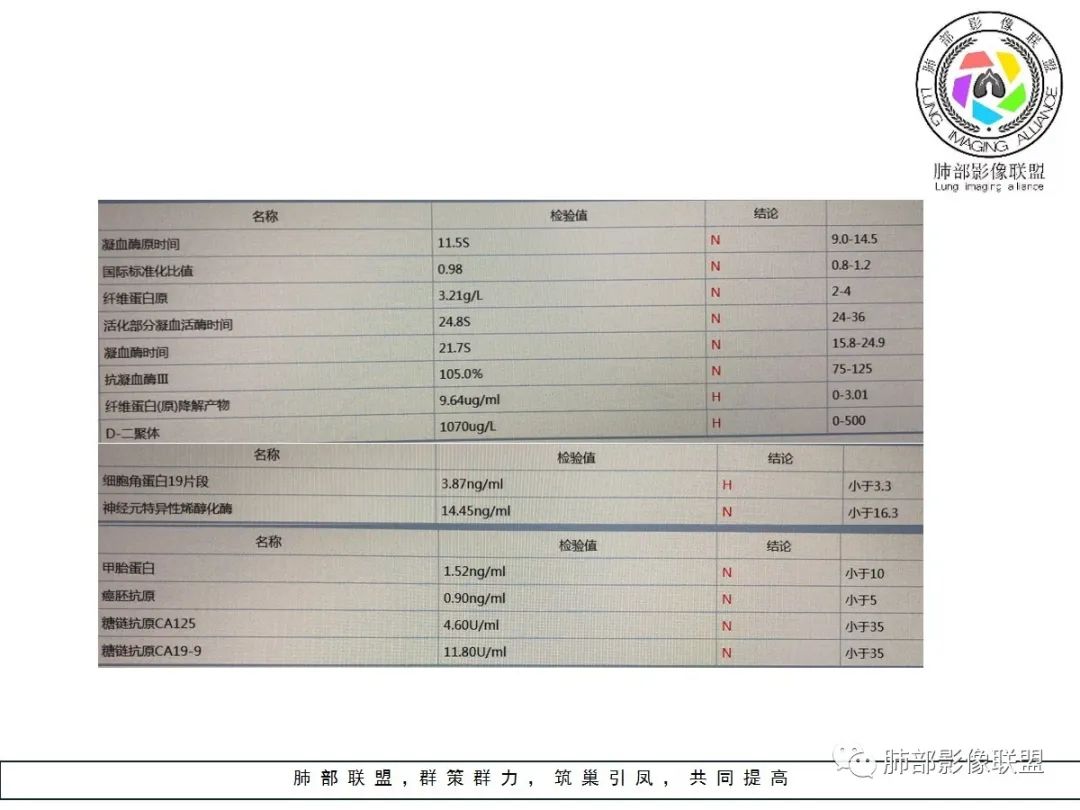 【病例】小征象大用途---脐凹征