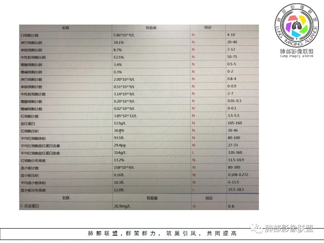 【病例】小征象大用途---脐凹征