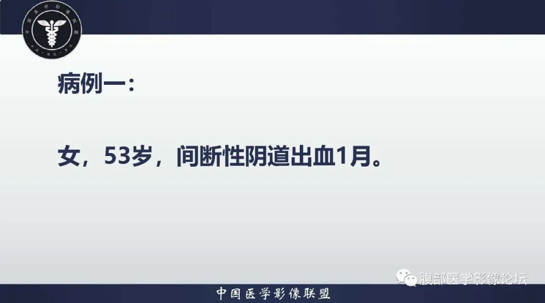 【病例】子宫内膜息肉1例MR影像