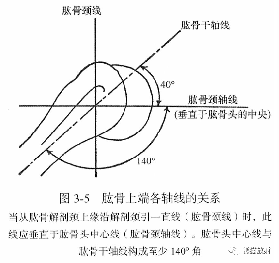 骨关节画线及测量