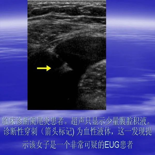 【PPT】急腹症影像诊断与鉴别诊断