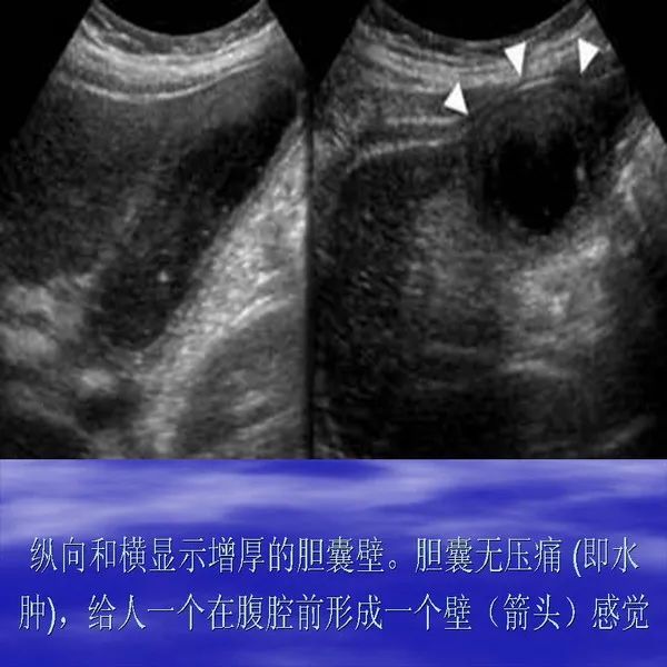 【PPT】急腹症影像诊断与鉴别诊断