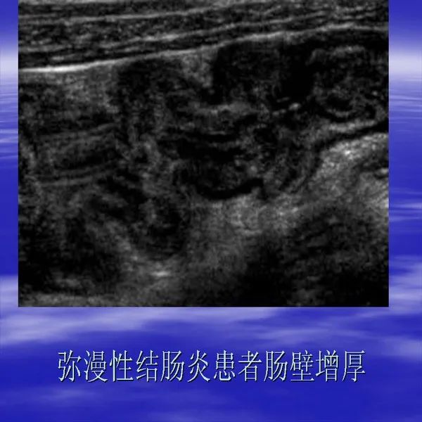 【PPT】急腹症影像诊断与鉴别诊断