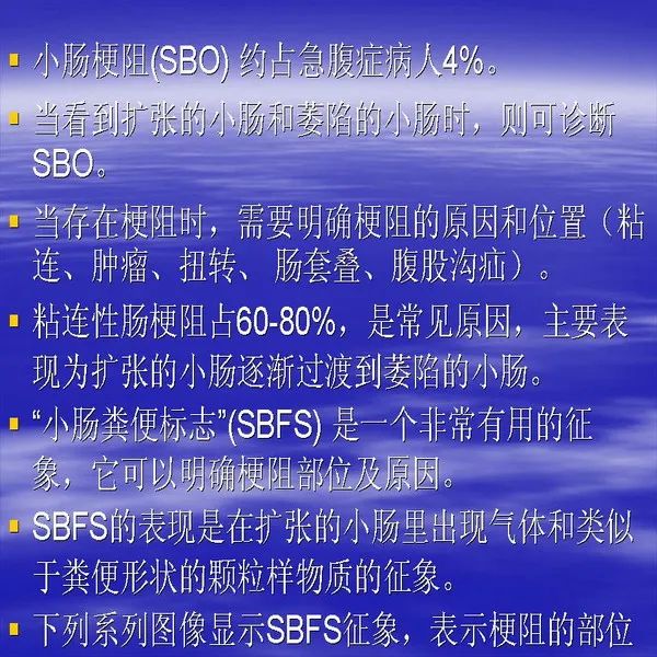 【PPT】急腹症影像诊断与鉴别诊断
