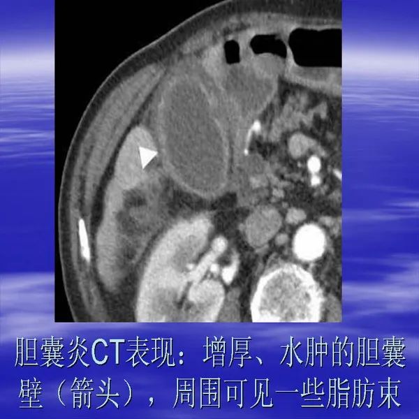 【PPT】急腹症影像诊断与鉴别诊断