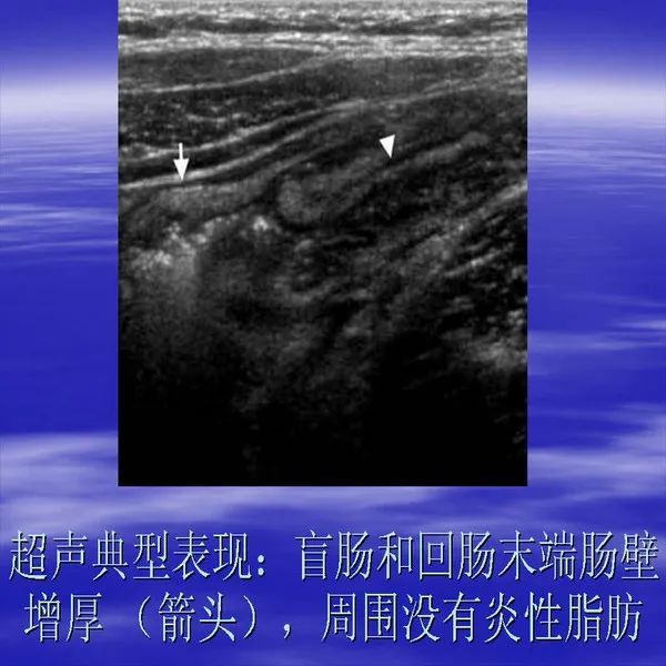 【PPT】急腹症影像诊断与鉴别诊断