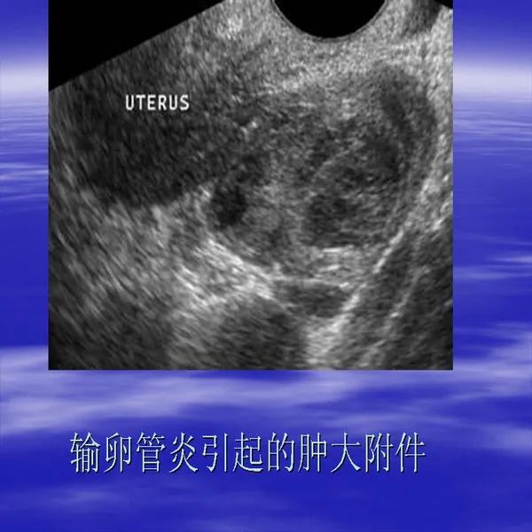 【PPT】急腹症影像诊断与鉴别诊断