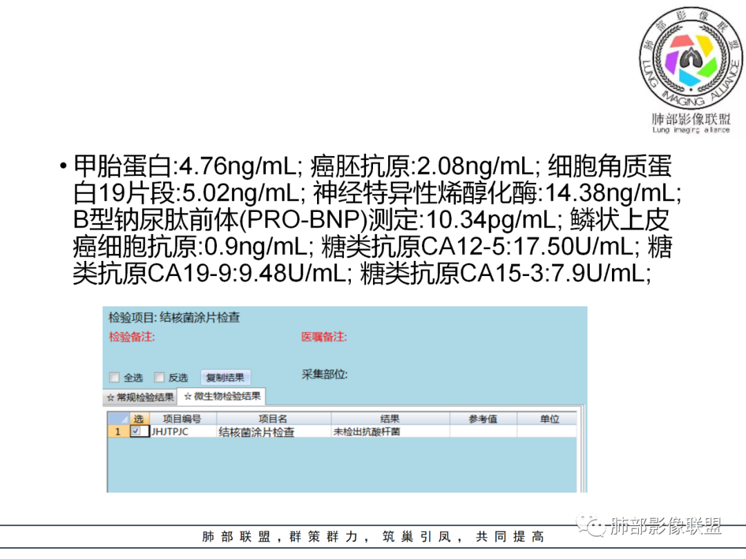 【病例】易误诊的肺结核1例CT影像讨论
