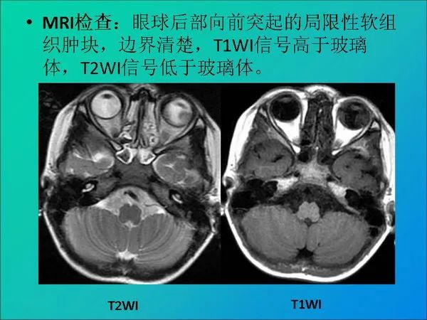 【PPT】常见眶内肿瘤影像诊断与鉴别诊断