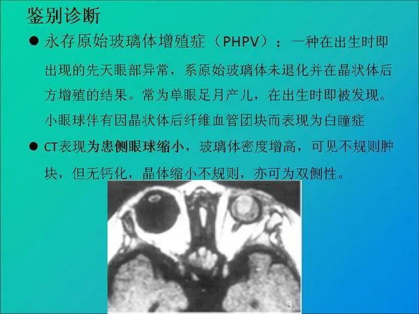 【PPT】常见眶内肿瘤影像诊断与鉴别诊断