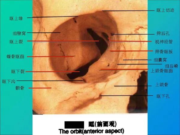 【PPT】常见眶内肿瘤影像诊断与鉴别诊断