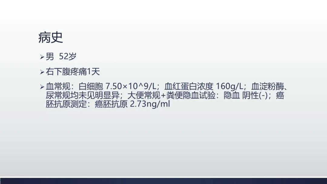 【病例】肠壁海绵状淋巴管瘤伴套叠1例CT