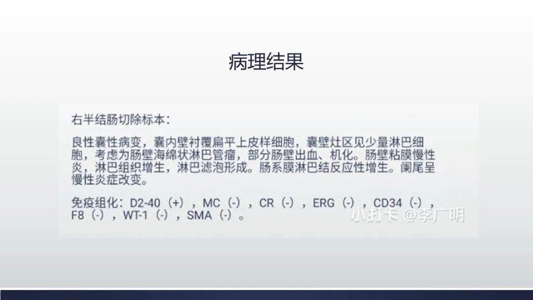 【病例】肠壁海绵状淋巴管瘤伴套叠1例CT