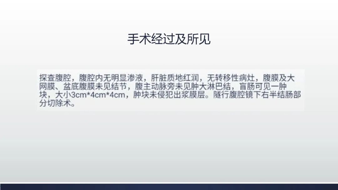 【病例】肠壁海绵状淋巴管瘤伴套叠1例CT