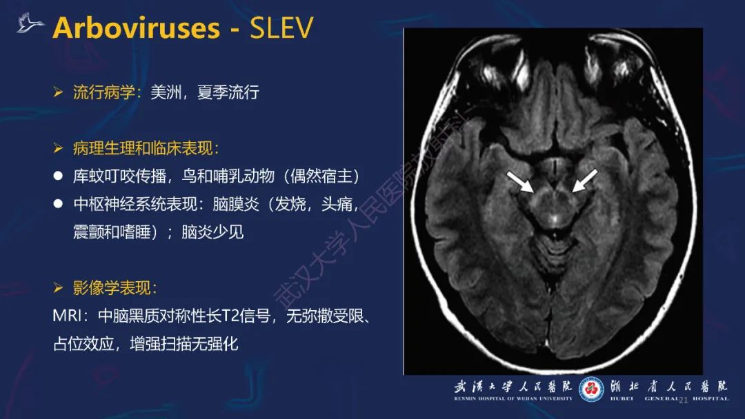 【PPT】新发和再发传染病神经影像学表现