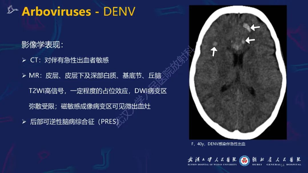 【PPT】新发和再发传染病神经影像学表现