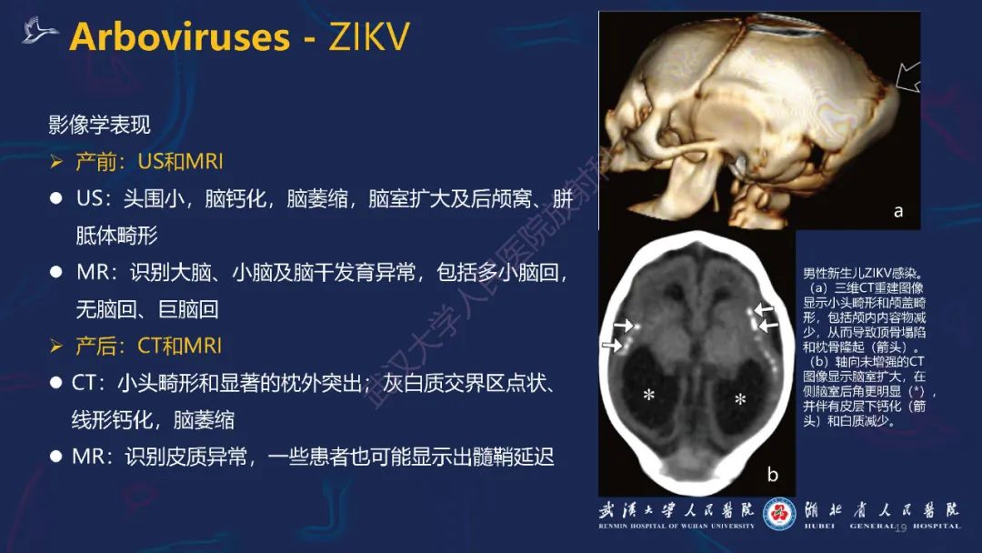 【PPT】新发和再发传染病神经影像学表现