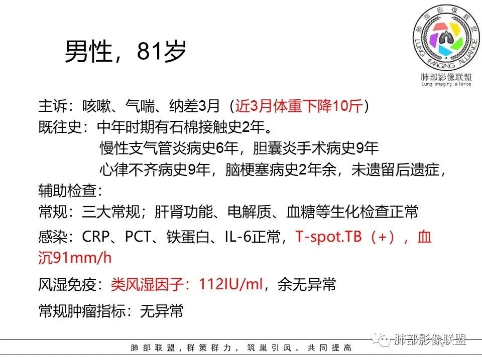 【病例】三明治征”之谜—胸膜淋巴瘤1例CT影像