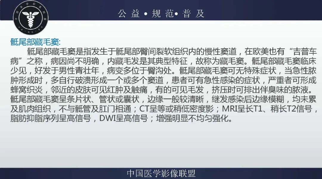 【病例】盆腔皮样囊肿1例MR影像