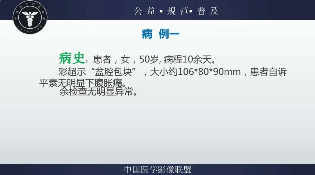 【病例】盆腔皮样囊肿1例MR影像