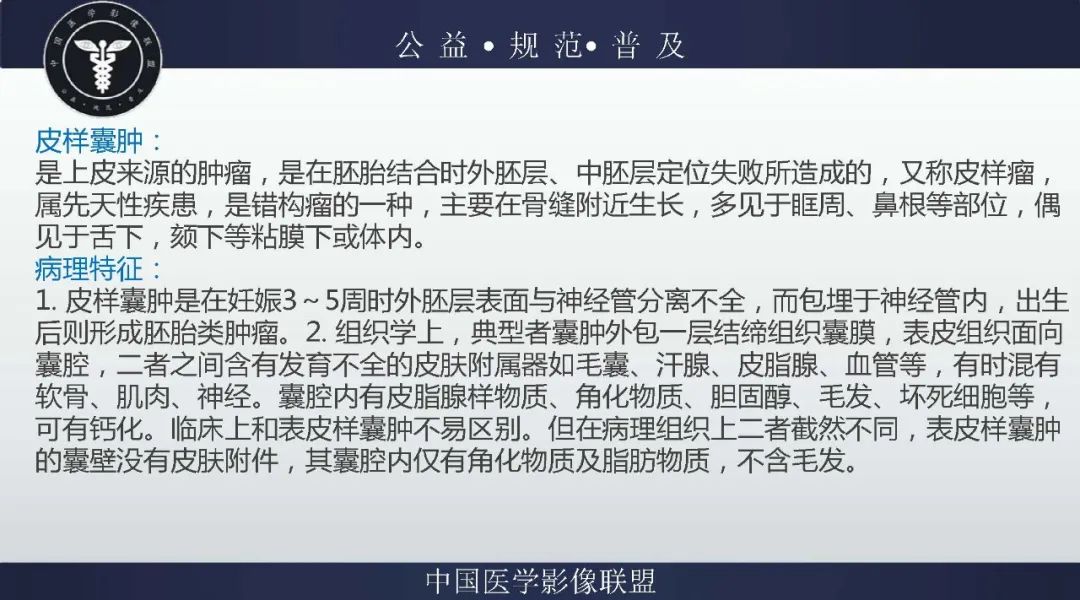 【病例】盆腔皮样囊肿1例MR影像