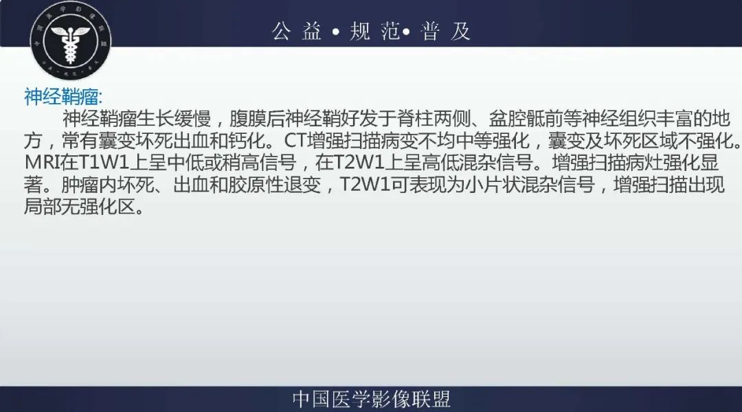 【病例】盆腔皮样囊肿1例MR影像