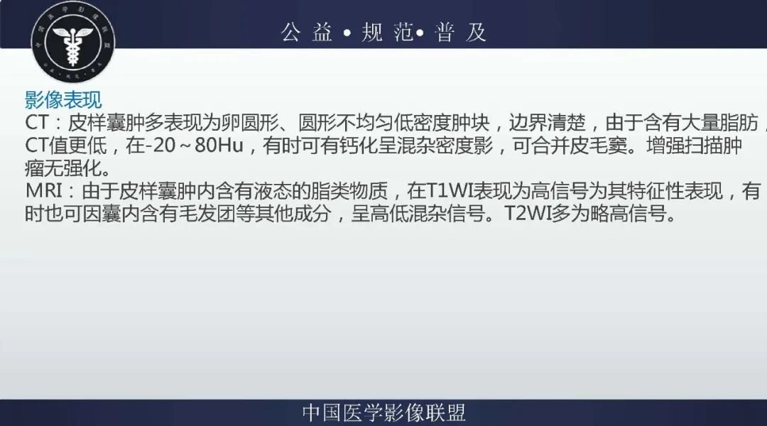 【病例】盆腔皮样囊肿1例MR影像