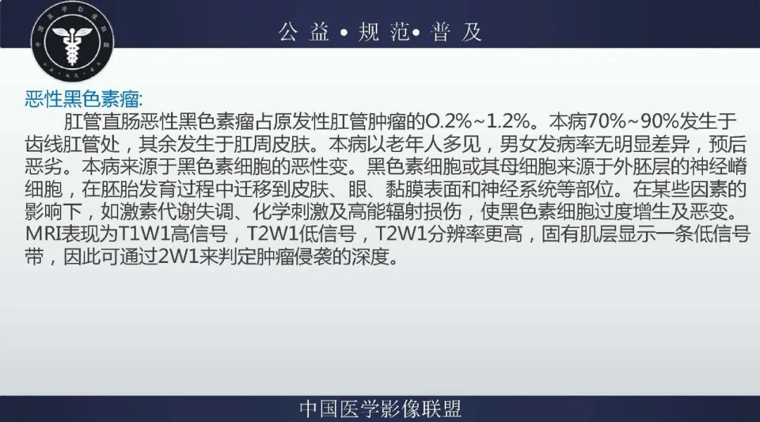 【病例】盆腔皮样囊肿1例MR影像