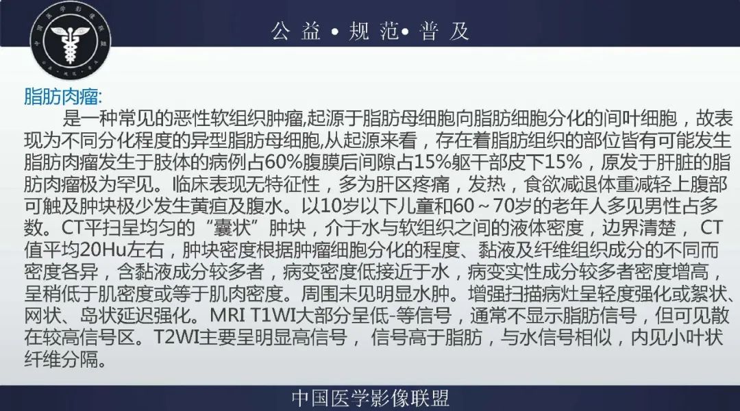 【病例】盆腔皮样囊肿1例MR影像