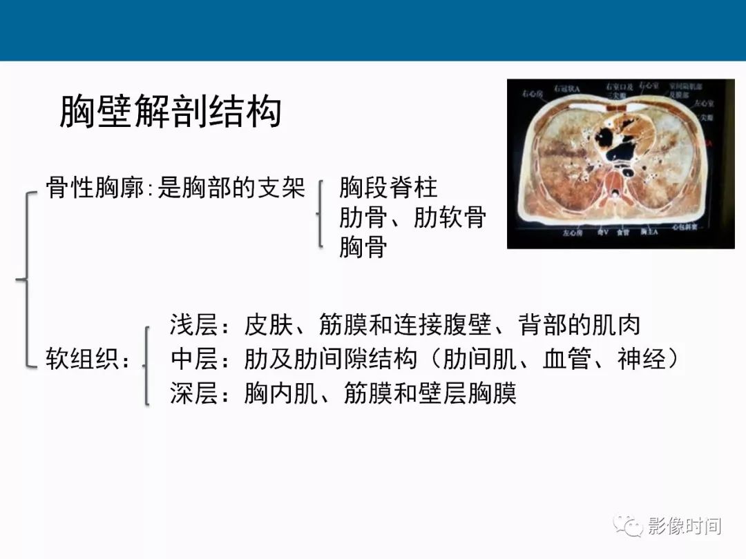 【PPT】胸壁恶性肿瘤的影像学评估