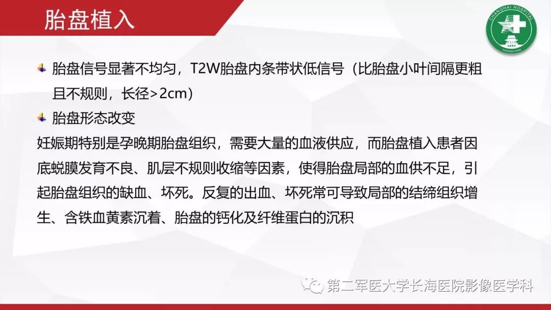 【PPT】胎盘植入的MRI征象