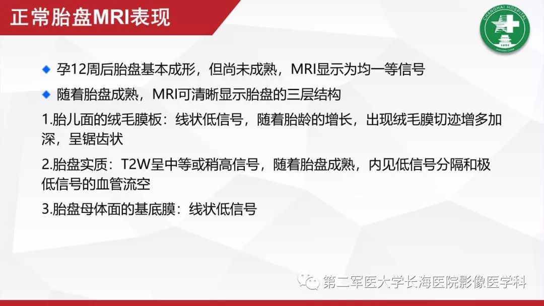 【PPT】胎盘植入的MRI征象