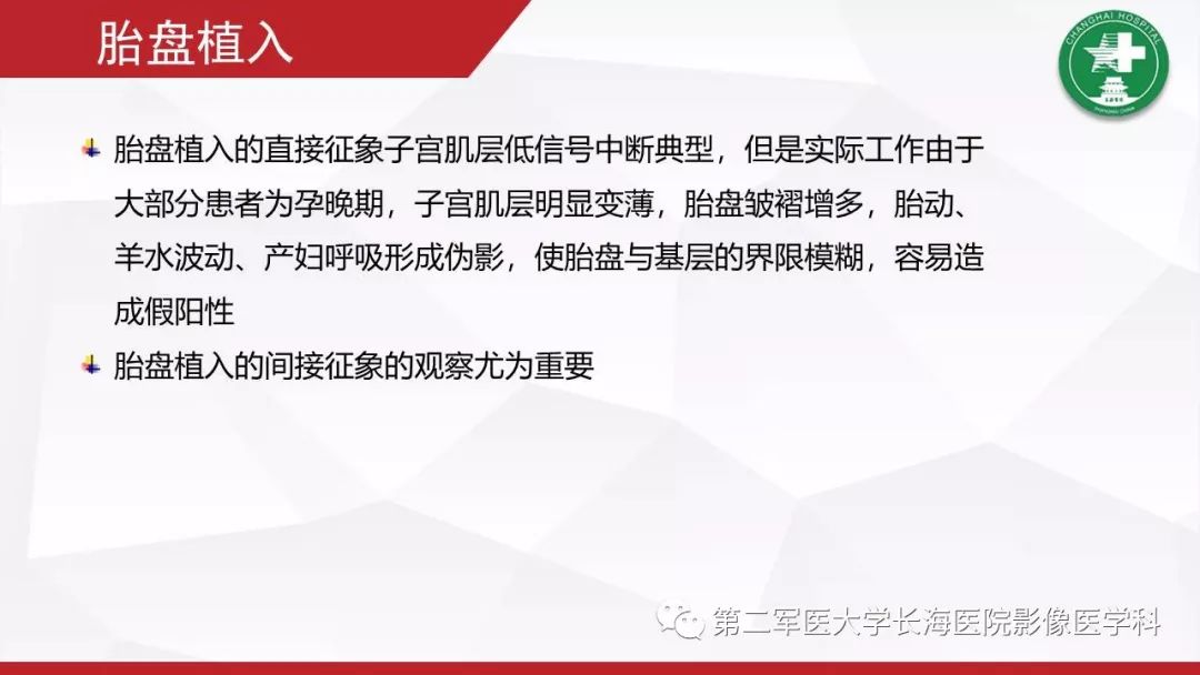 【PPT】胎盘植入的MRI征象