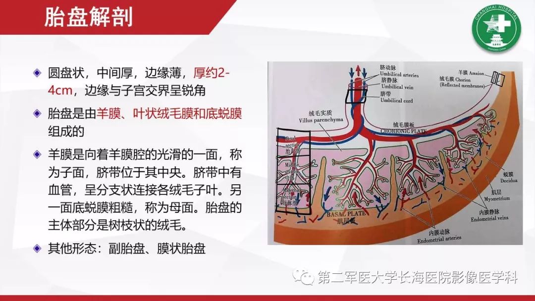 【PPT】胎盘植入的MRI征象