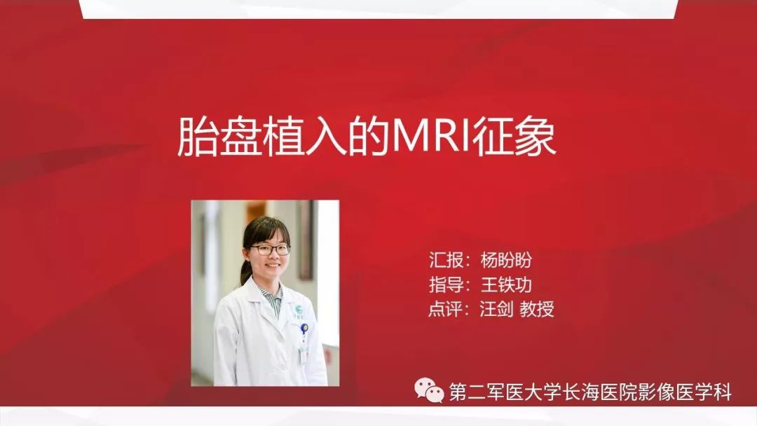 【PPT】胎盘植入的MRI征象