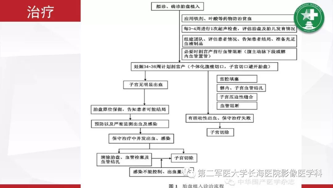 【PPT】胎盘植入的MRI征象