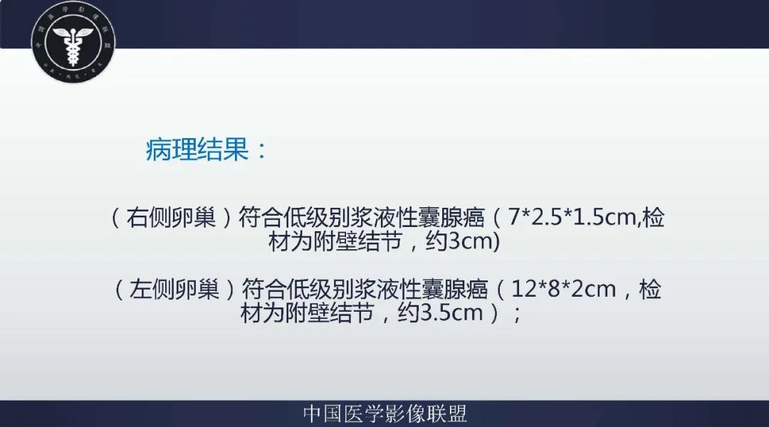 【病例】卵巢低级别浆液性囊腺癌1例CT及MR影像