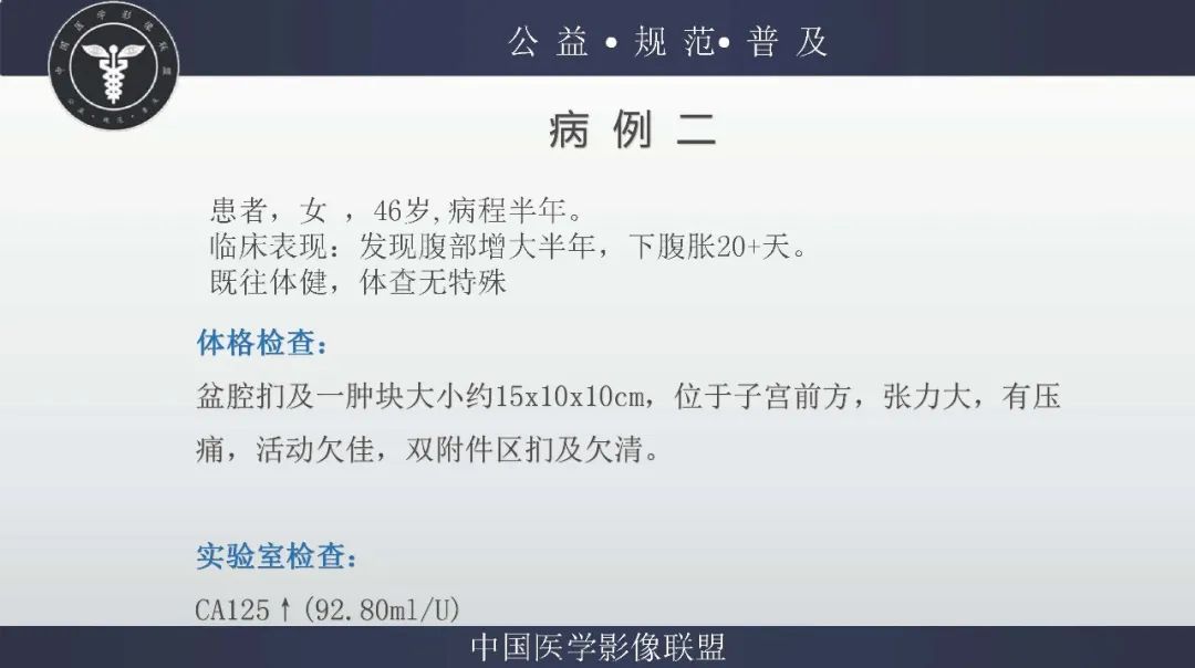 【病例】卵巢低级别浆液性囊腺癌1例CT及MR影像